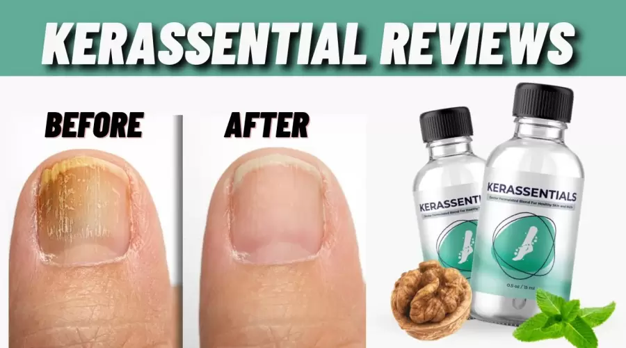 KERASSENTIALS SUPPLEMENTS STILL WORTH IT IN 2026 ?