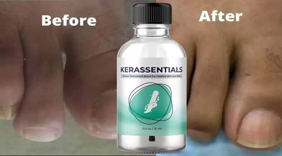 Kerassentials Review  (SCAM OR LEGIT) — Really Work?