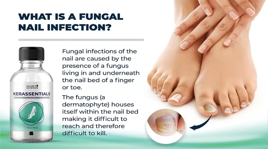 Kerassentials Supplement (Trick or Genuine) - Is It Great!